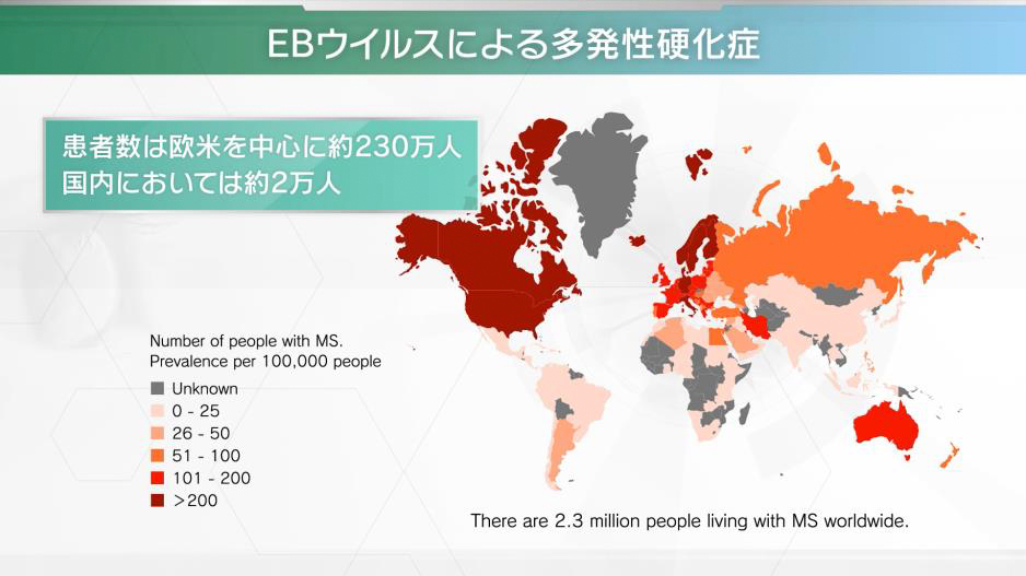 EBウイルスによる多発性硬化症