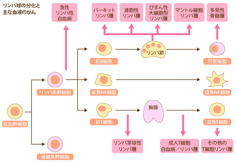 リンパ球の分化と主な血液のがん