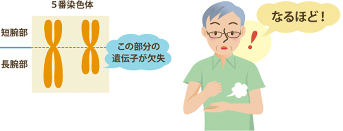 5q-症候群